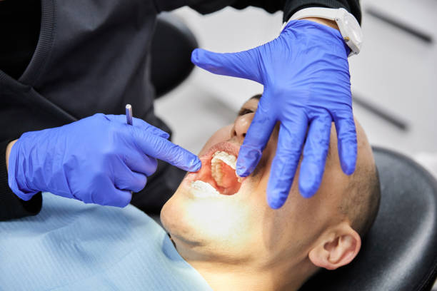 Best Broken or Chipped Tooth Repair in Whitesboro, NY